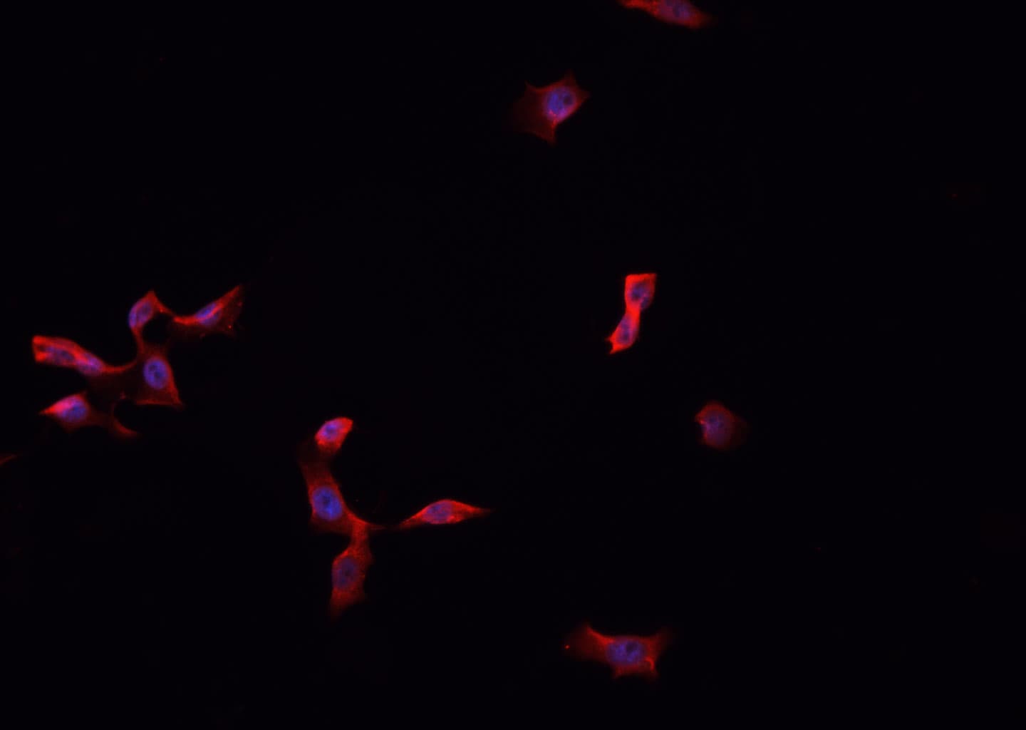 MPZ / P0 Antibody