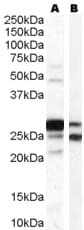 IHC-plus™ Polyclonal Goat anti-Human COMT Antibody (aa52-65, IHC, WB)