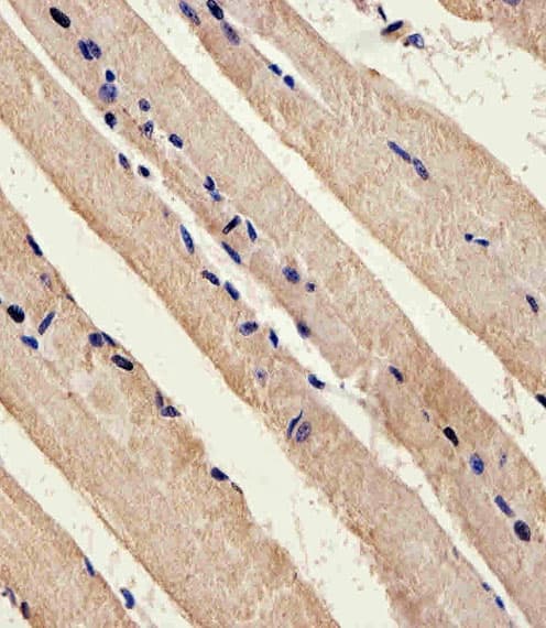 STK11 / LKB1 Antibody (aa393-420)