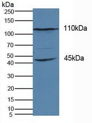 KIF18A Antibody (aa1-453, PE)