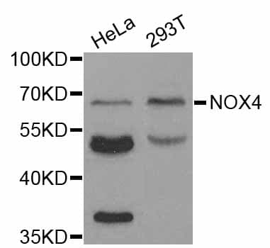 Polyclonal Rabbit anti-Human NOX4 Antibody (IHC, IF, WB)