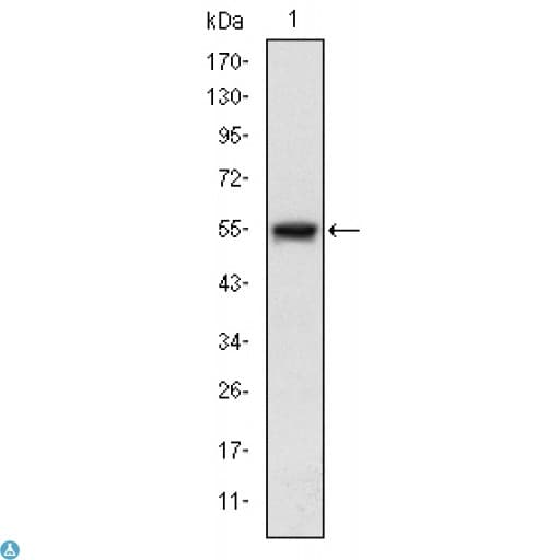 MAP3K5 / ASK1 Antibody