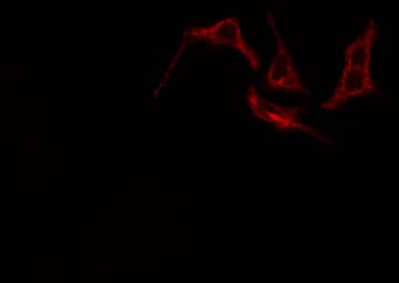 Polyclonal Rabbit anti-Human PTGIR / IP Receptor Antibody (IF, WB)