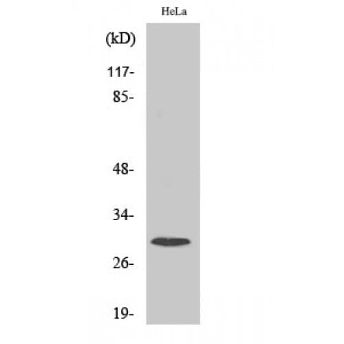 RPS4X + RPS4Y1 + RPS Antibody (50-130 aa, Internal)