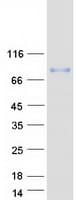 Human CD71 / Transferrin Receptor Protein (Recombinant Myc-DDK (Flag))