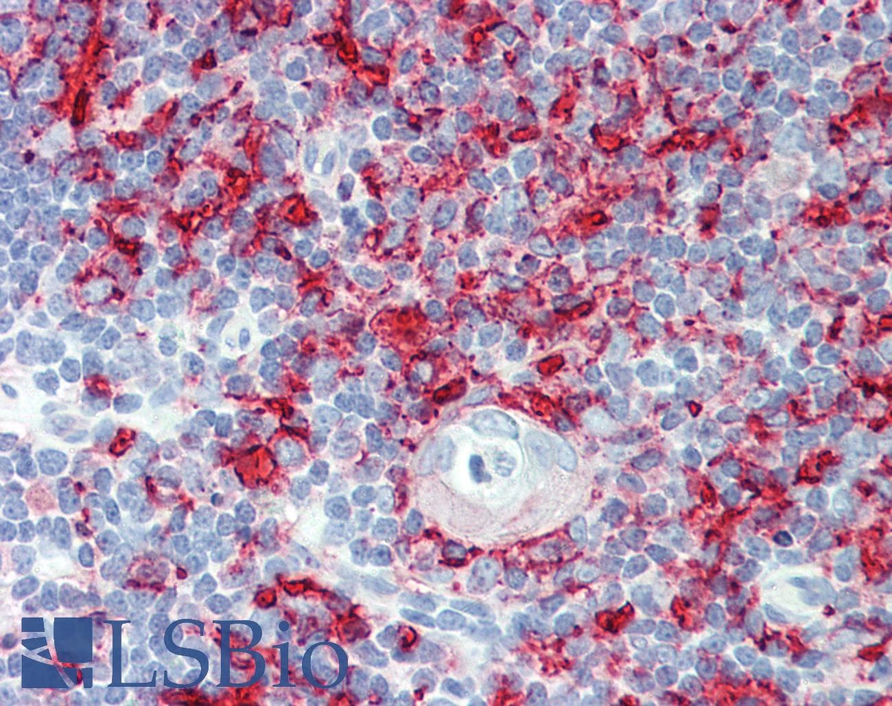 IHC-plus™ HLA-DP+DQ+DR Antibody (clone WR18)