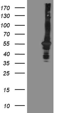 Monoclonal Mouse anti-Human OSGIN2 Antibody (clone OTI6E10, aa1-250, IHC, WB)