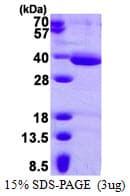 Human HAAO Protein (Recombinant His)