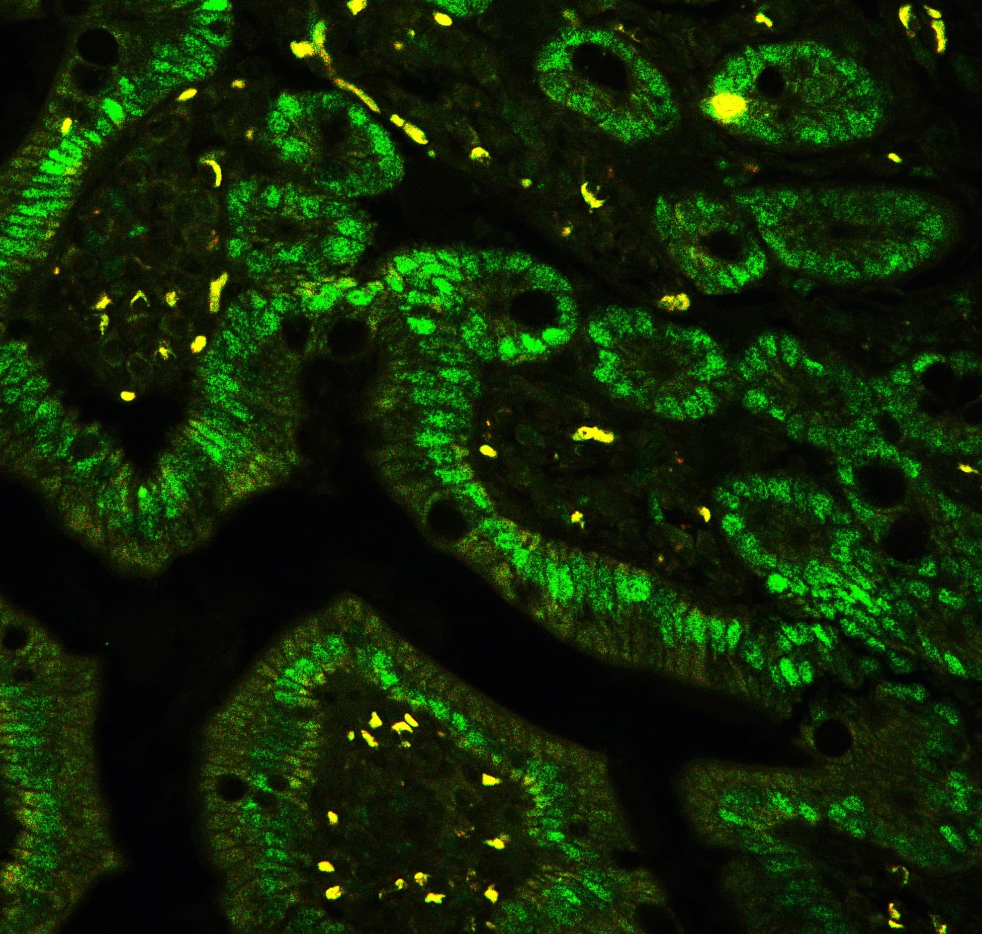 CTBP2 Antibody (aa321-445)