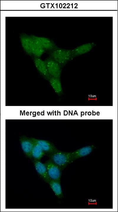 Polyclonal Rabbit anti-Human PRKD1 / PKC Mu Antibody (aa529-862, WB)