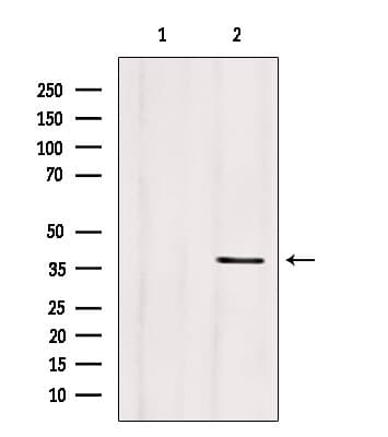 Polyclonal Rabbit anti-Human CLTA / LCA Antibody (IHC, WB)
