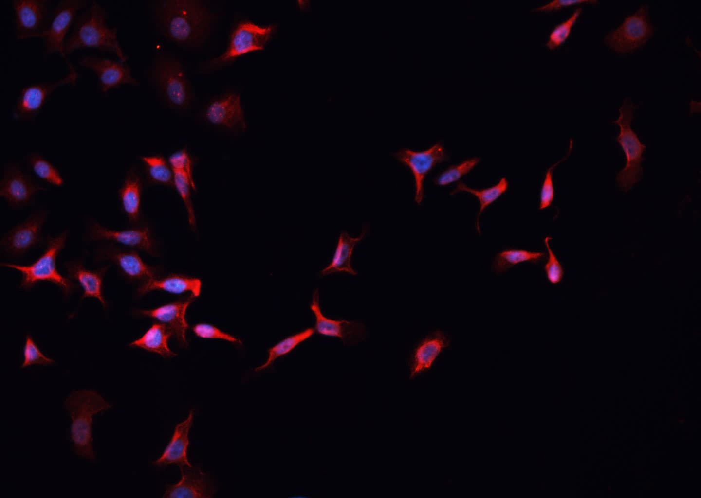 TRIM3 Antibody