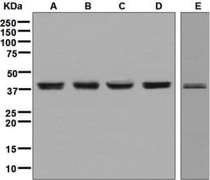 IHC-plus™ BMI1 / PCGF4 Antibody (Internal, clone EPR3745(2))
