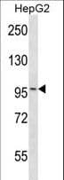 IHC-plus™ Polyclonal Rabbit anti-Mouse MAP4K3 / GLK Antibody (aa501-529, IHC, WB)
