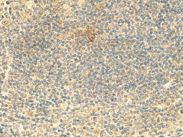 ARL4D Antibody