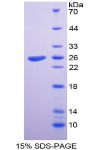 Mouse TLN1 / Talin 1 Protein (Recombinant His, N-Terminal)