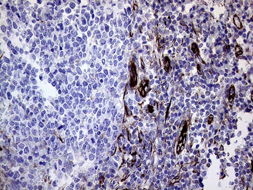 Monoclonal Mouse anti-Human MLPH / Melanophilin Antibody (clone OTI6E3, Carrier-free, aa295-600, IHC, WB)