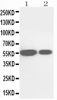 CYP2E1 Antibody (aa94-112)