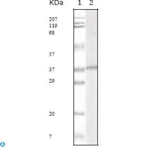 HHV-8 ORF62 Antibody