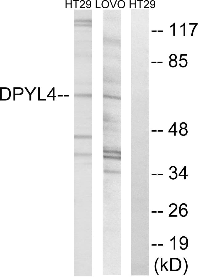 DPYSL4 / CRMP3 Antibody (aa91-140)