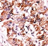 CHEK1 / CHK1 Antibody (phospho-Ser317)