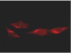 IHC-plus™ TP53 / p53 Antibody (clone BP53-12)