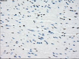 Monoclonal Mouse anti-Human BUB1B / BubR1 Antibody (clone OTI6E5, IHC, IF, WB)