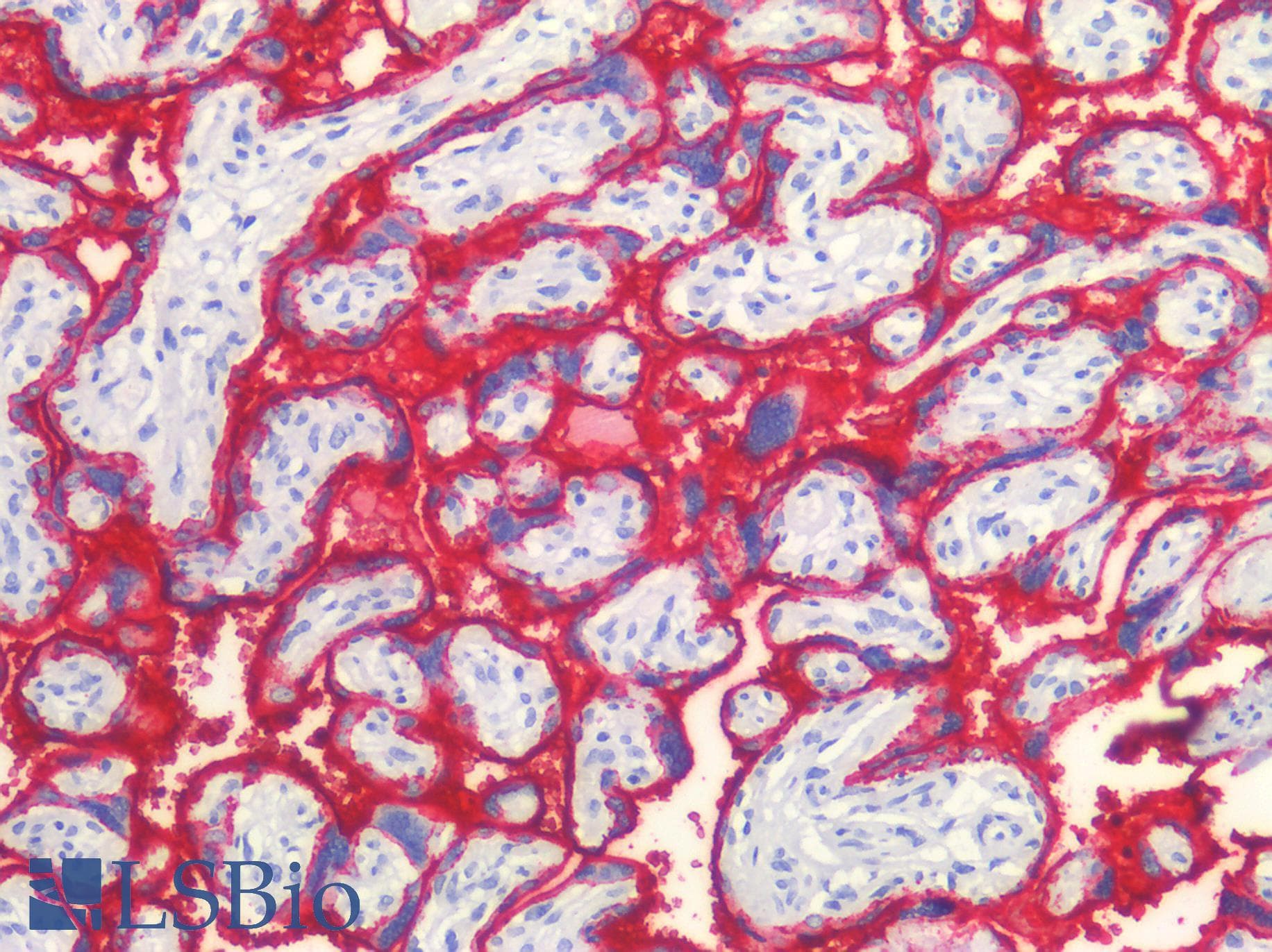 IHC-plus™ PLAP / Alkaline Phosphatase Antibody (clone SPM593)