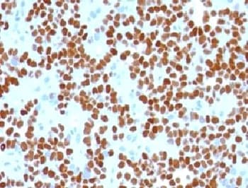 NKX2-2 Antibody (clone NK2TF-1, Ready-to-Use)