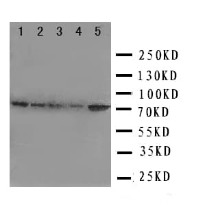Polyclonal Rabbit anti-Human HSPA9 / Mortalin / GRP75 Antibody (aa591-609, IHC, WB)