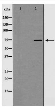CDH13 / Cadherin 13 Antibody