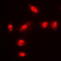 FOXO1 / FKHR Antibody (phospho-Ser256)