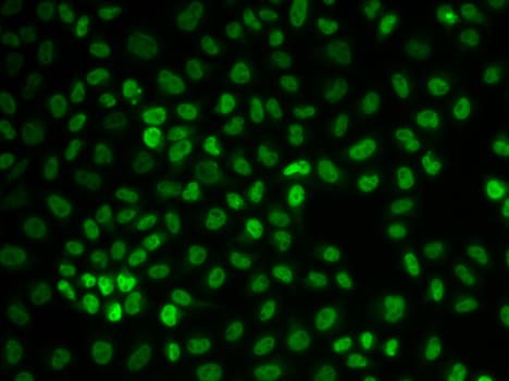 U2AF2 / U2AF65 Antibody