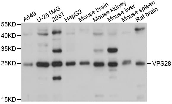 Polyclonal Rabbit anti-Human VPS28 Antibody (WB)