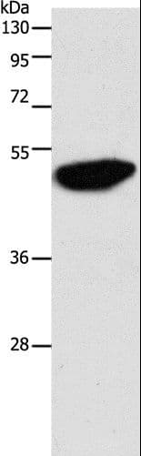 PathPlus™ Polyclonal Rabbit anti-Human ENO2 / NSE Antibody (IHC, WB)