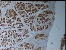 EMA / MUC1 Antibody (aa1192-1241)