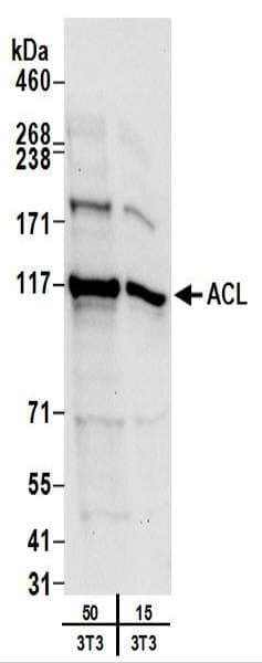 ACLY / ATP Citrate Lyase Antibody (aa1051-1101)