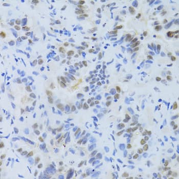 SRSF1 / SF2 Antibody