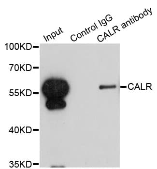 Polyclonal Rabbit anti-Human CALR / Calreticulin Antibody (IHC, IF, WB)