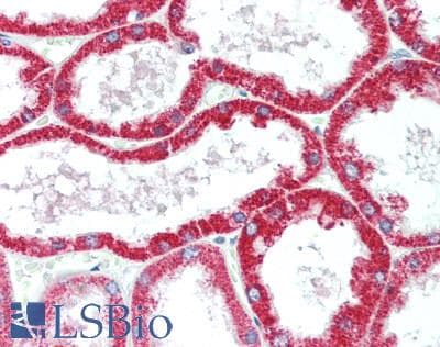PRKAA2 / AMPK Alpha 2 Antibody (aa343-552)