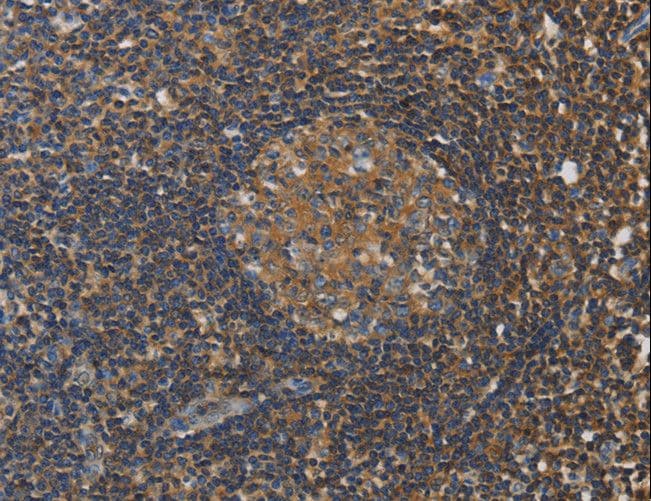 RAD54L2 Antibody