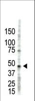 PRMT2 Antibody (aa22-53)