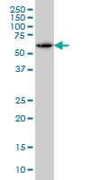 IHC-plus™ Monoclonal Mouse anti-Human SH3BP5 / SAB Antibody (clone 2B3, IHC, IF, WB)