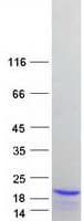 Human NCBP2 / CBP20 Protein (Recombinant Myc-DDK (Flag))