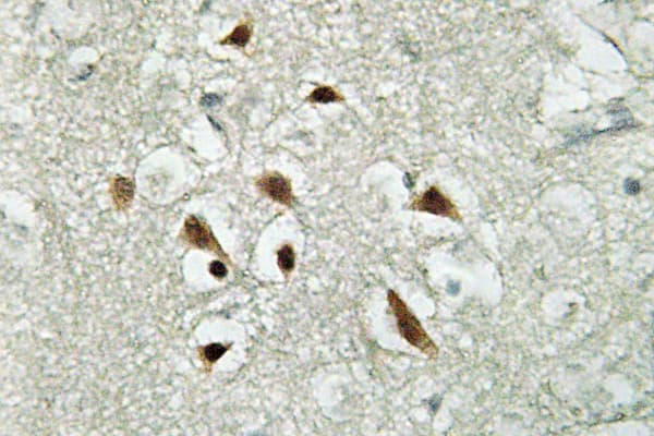 FUBP3 Antibody (Arg241)