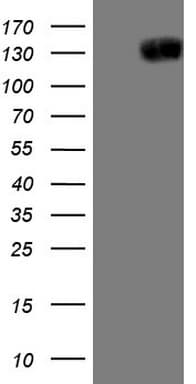 JAG1 / Jagged 1 Antibody (aa523-759, clone OTI3A10)