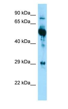 Polyclonal Rabbit anti-Human KRT6A / CK6A / Cytokeratin 6A Antibody (aa240-289, IHC, WB)