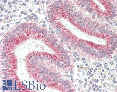 IHC-plus™ PIK3C3 / VPS34 Antibody (Ser425)