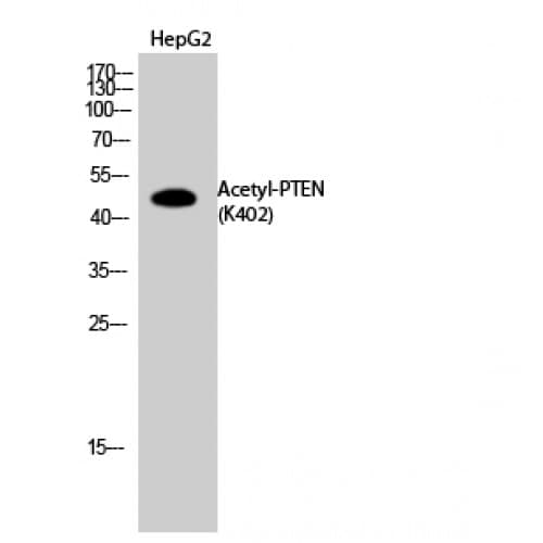 Polyclonal Rabbit anti-Human PTEN Antibody (around the acetylation site of K402., WB)