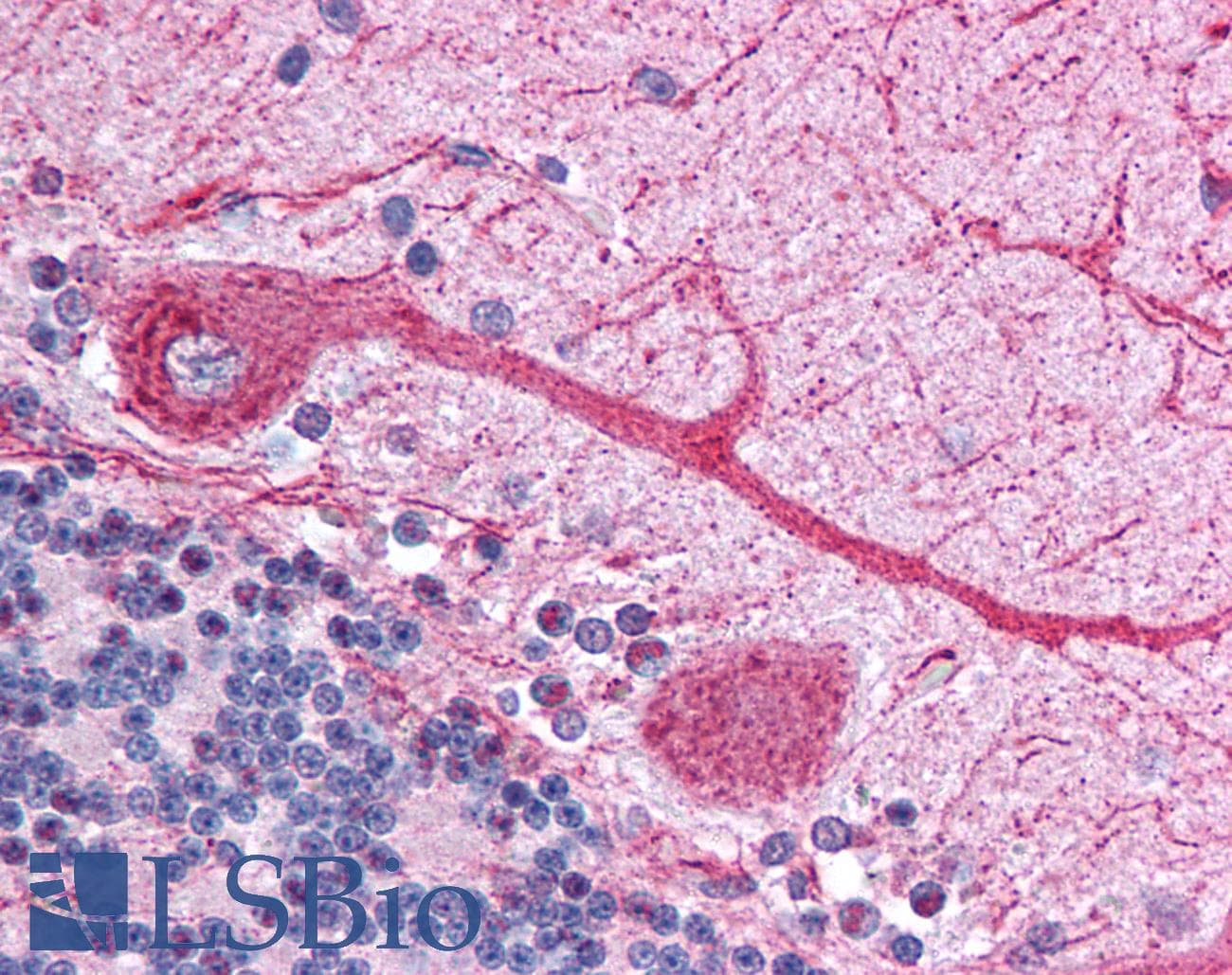 IHC-plus™ DCLRE1C / Artemis Antibody (aa677-692)